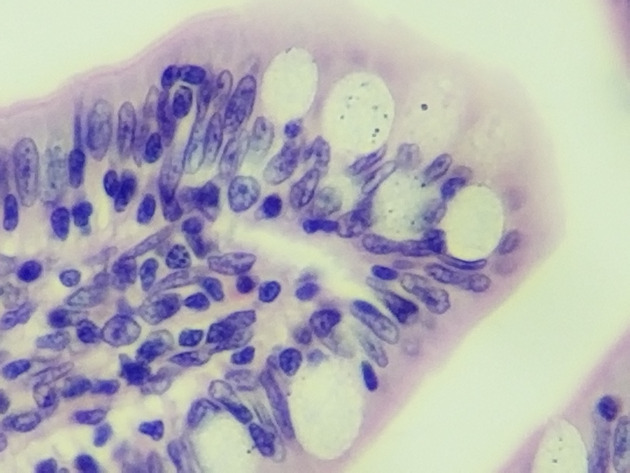 Simple Columnar Epithelium Slides - Simple Columnar Epithelium 09 400X